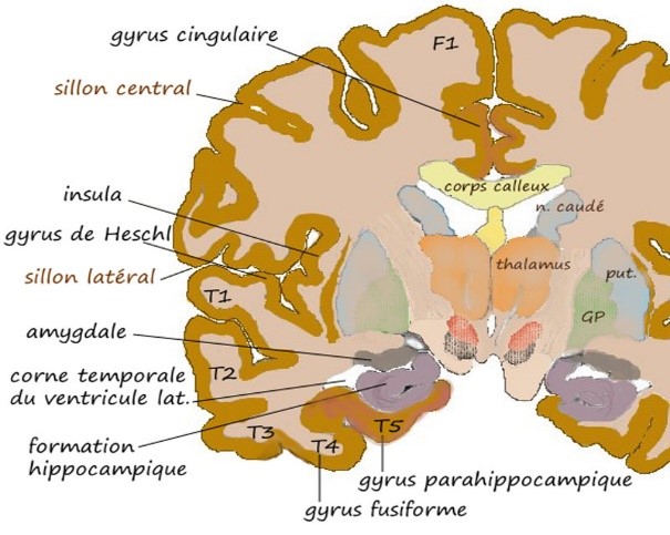 Chirurgie du cerveau